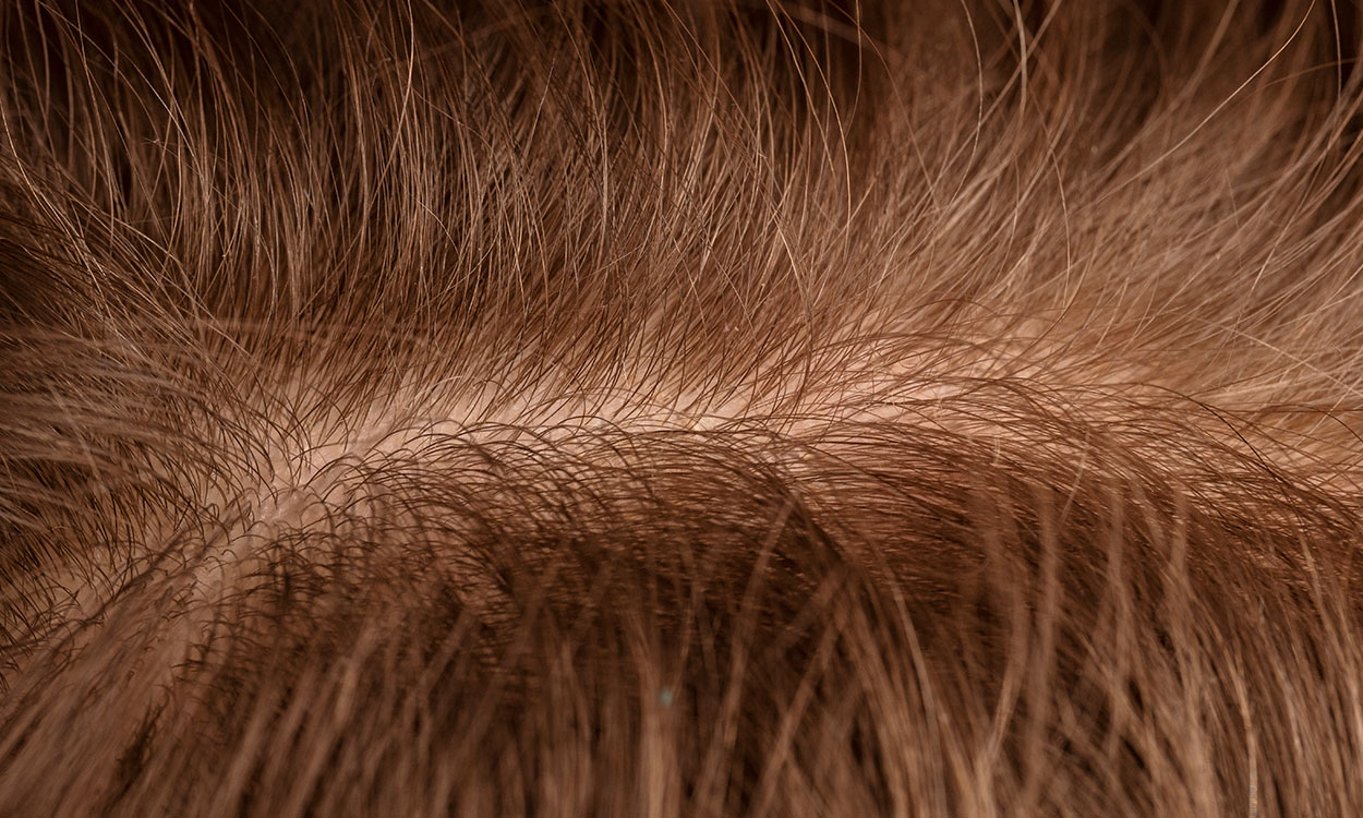 El cuero cabelludo: base de la salud de nuestro cabello